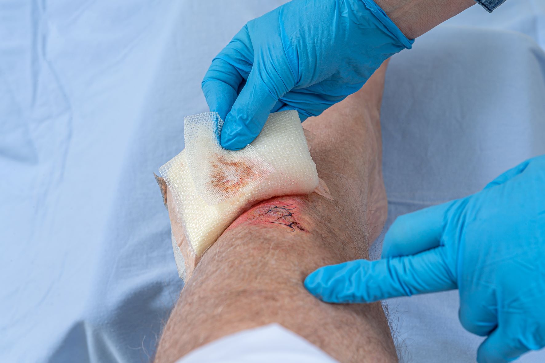 heridas